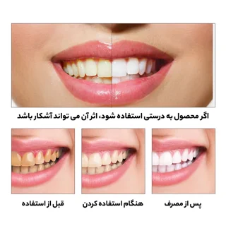 قیمت و خرید قطره سفید کننده دندان لانبنا | با قیمت ویژه