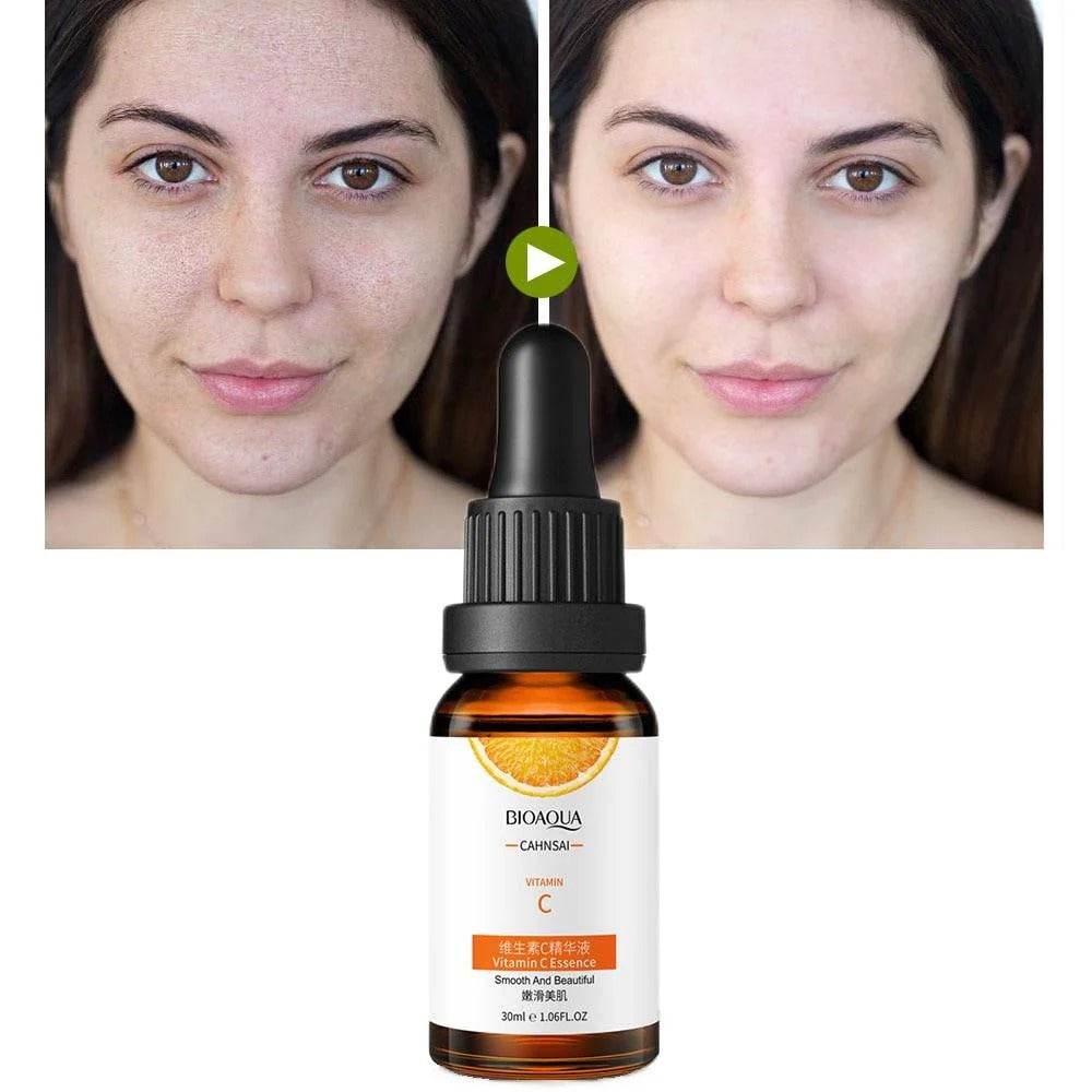 همه چیز درباره سرم ویتامین سی و نحوه استفاده از آن